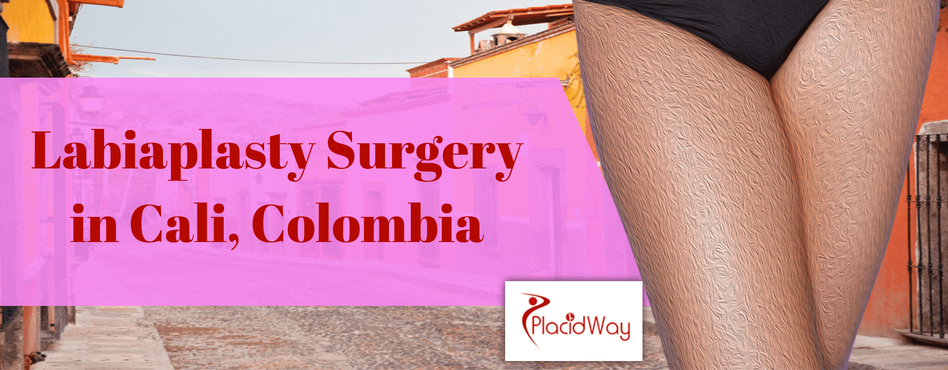 Labiaplasty in Cali, Colombia